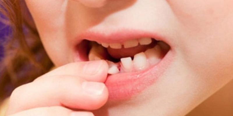 Mơ thấy rụng nguyên hàm răng là gì?